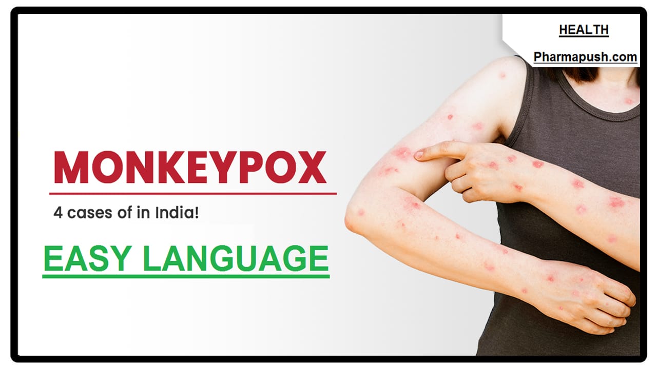 Define Monkeypox