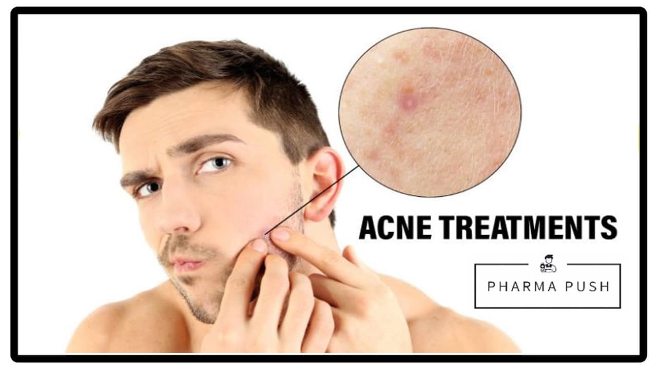 how to treat acne problems